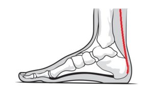 Foot bones showing possible locations of pain in the heelof 