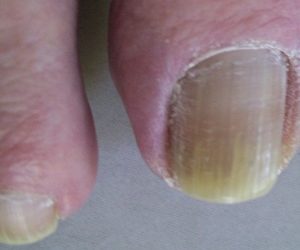Men’s toenails…human or not?